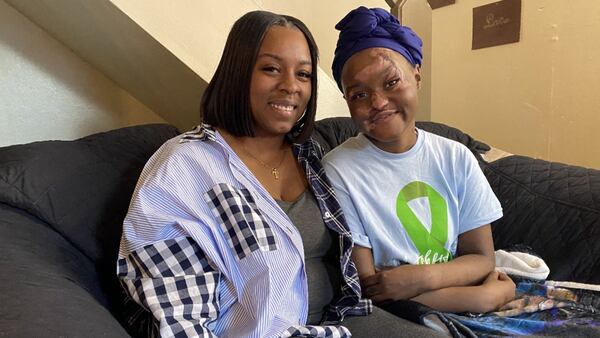Memphis teen returns home 3 months after crash leaves her badly burned