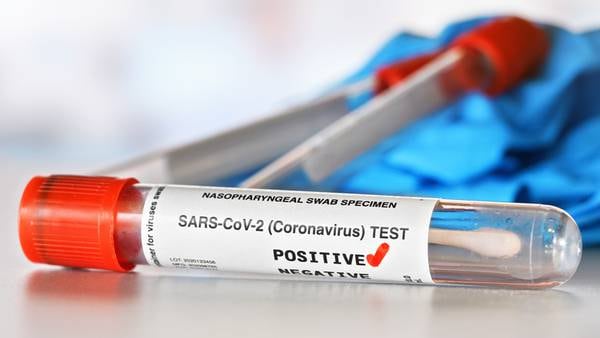 One in five Americans have been infected with COVID-19, according to statistics
