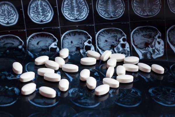 New Alzheimer’s drug lecanemab shows promise in slowing cognitive decline